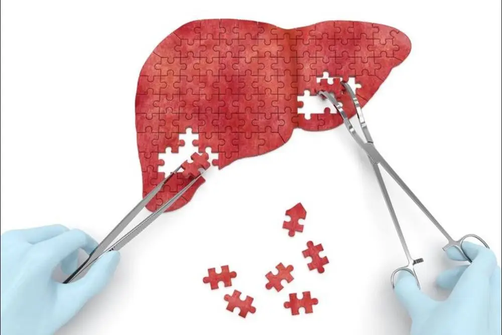 Liver Abscess Drainage Procedure Step-by-Step Explanation